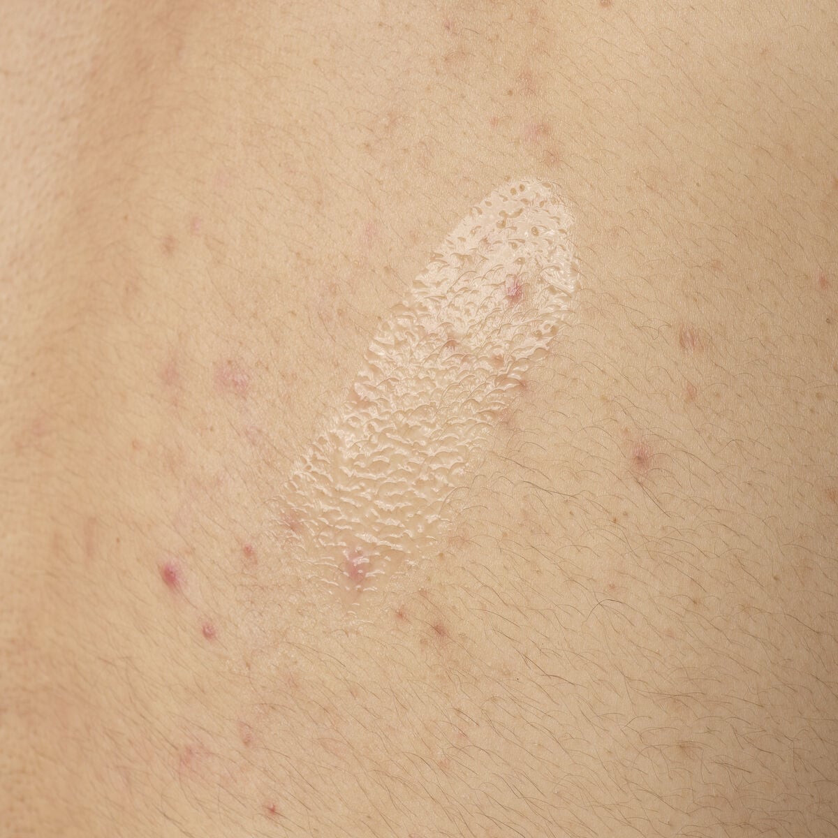 salicylic-acid-0-5-body-serum-k4 ORD-salicylic-acid-05-body-240ml-application.jpg