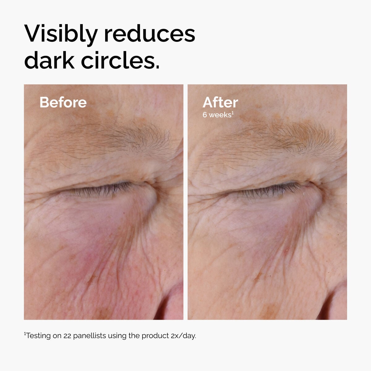 caffeine-solution-5-egcg-eye-serum-j6 ord-caffeine-solution-egcg-dark-circles-before-after.jpg