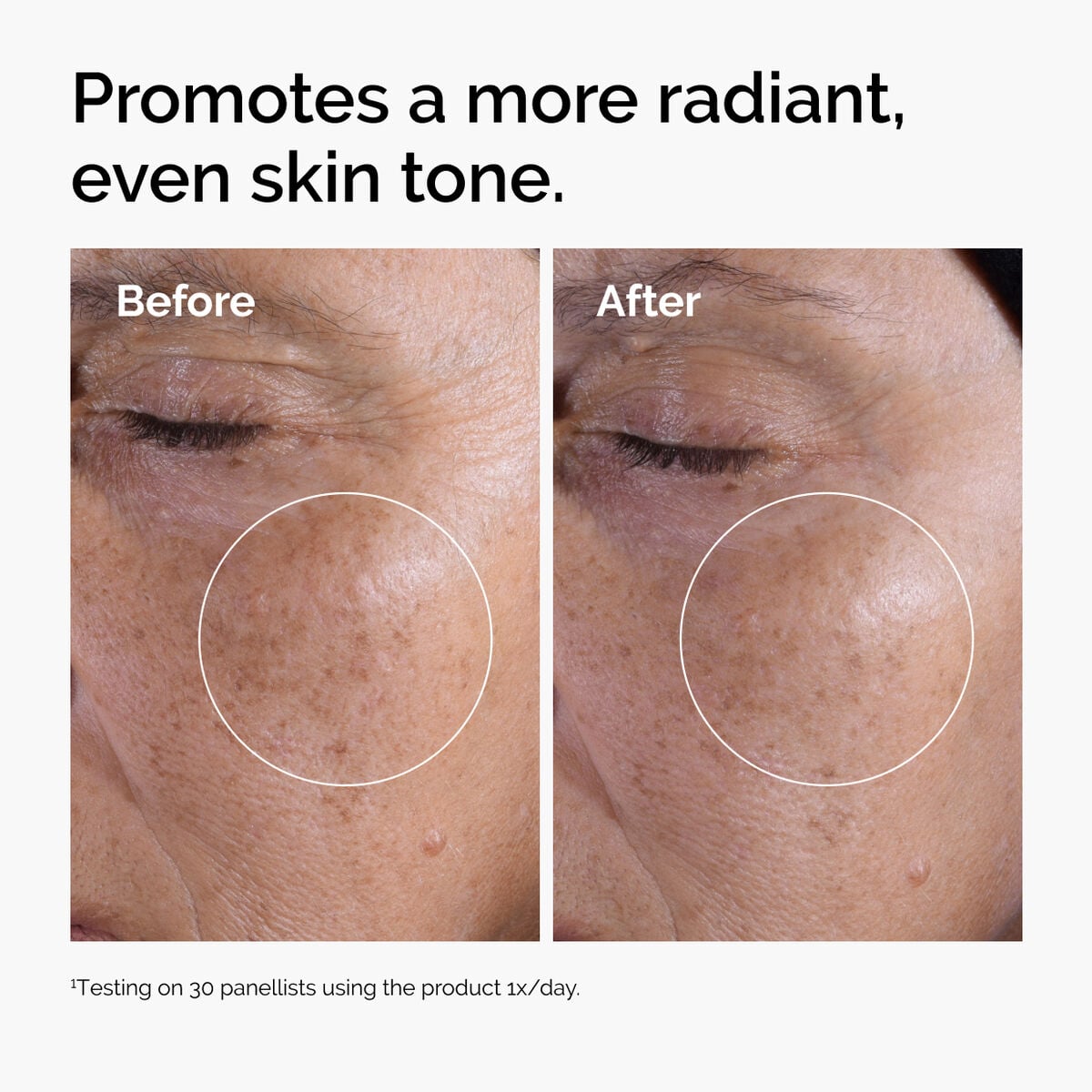 glycolic-acid-7-exfoliating-toner-k9 ord-glycolic-before-after-radiance.jpg