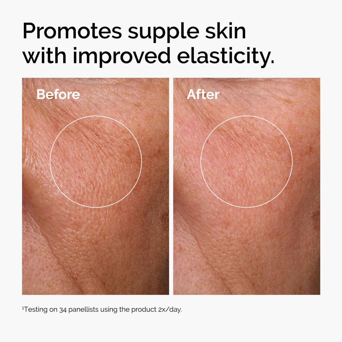 hyaluronic-acid-2-b5-with-ceramides-z8 ord-hyaluronic-acid-2pct-b5-hydrating-serum-before-after-elasticity.jpg