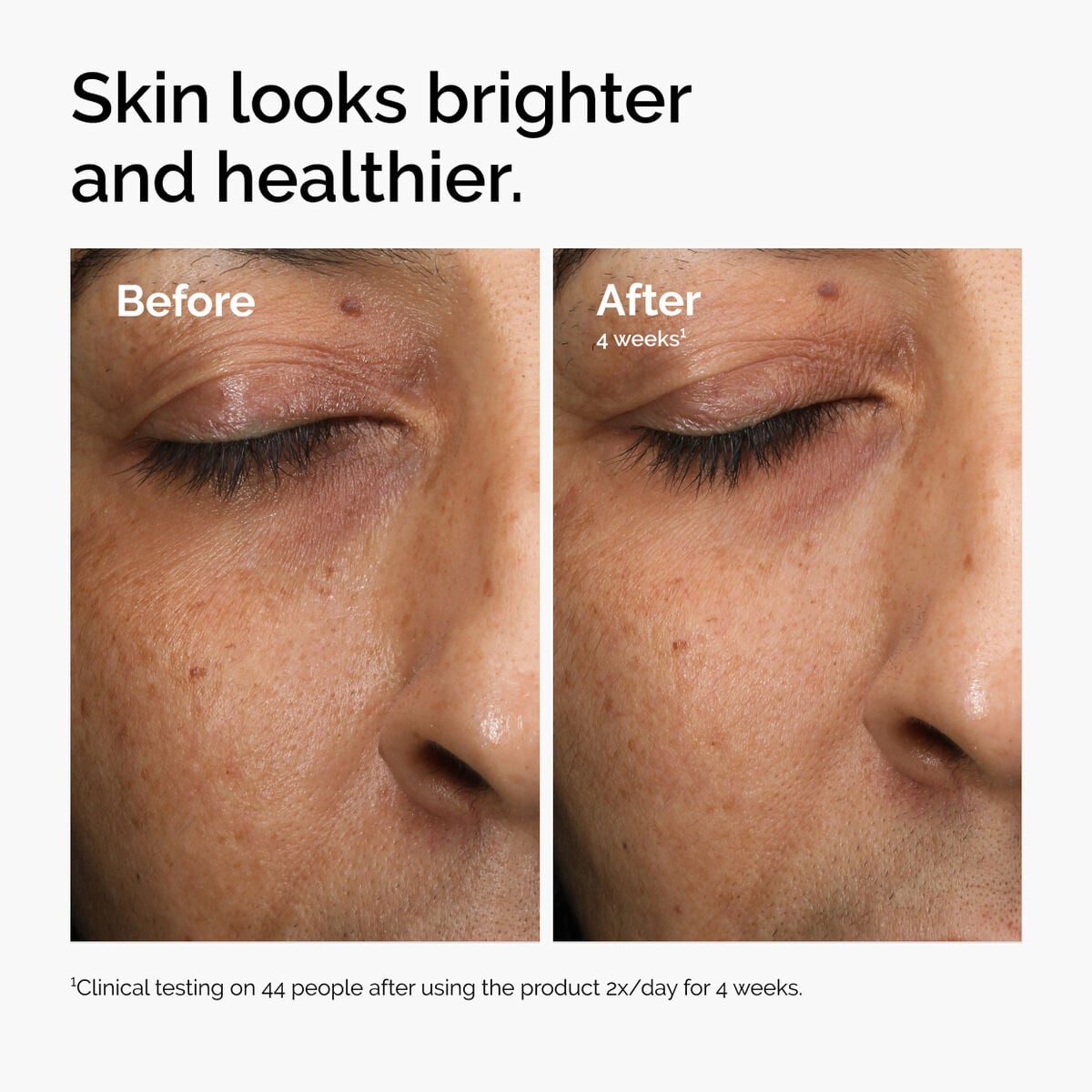 multi-antioxidant-radiance-serum-r9 ord-mars-before-after-healthy.jpg