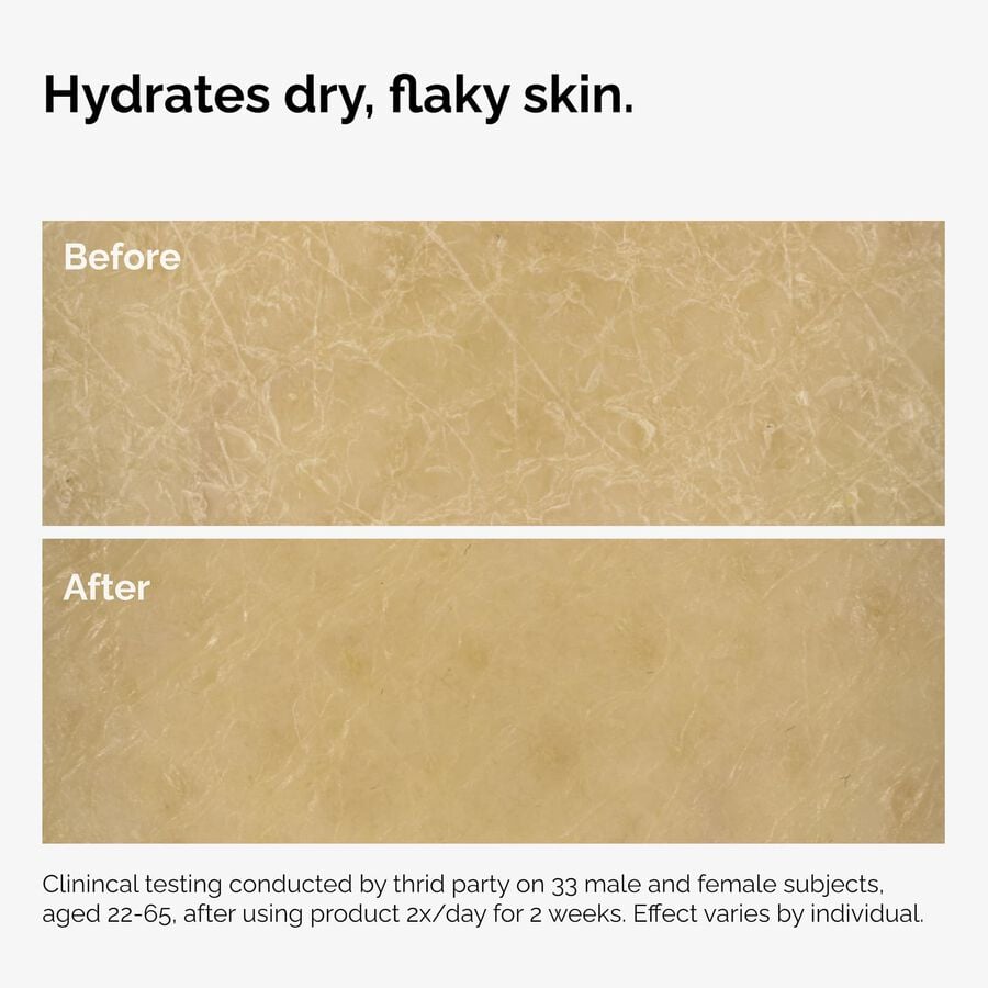 the-body-care-collection-c8 ord-natural-moisturizing-factors-inulin-body-before-after-graphic-02.jpg