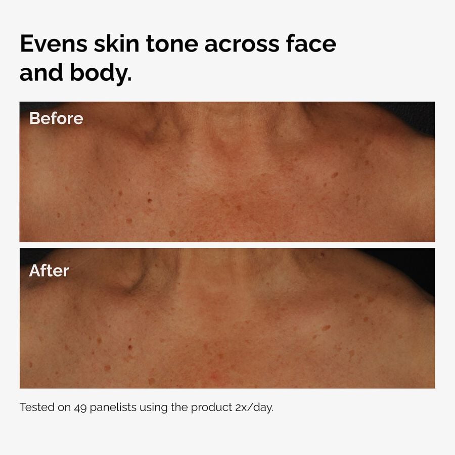 the-body-care-collection-c8 ord-niacinamide-face-body-serum-before-after-even-tone-graphic.jpg