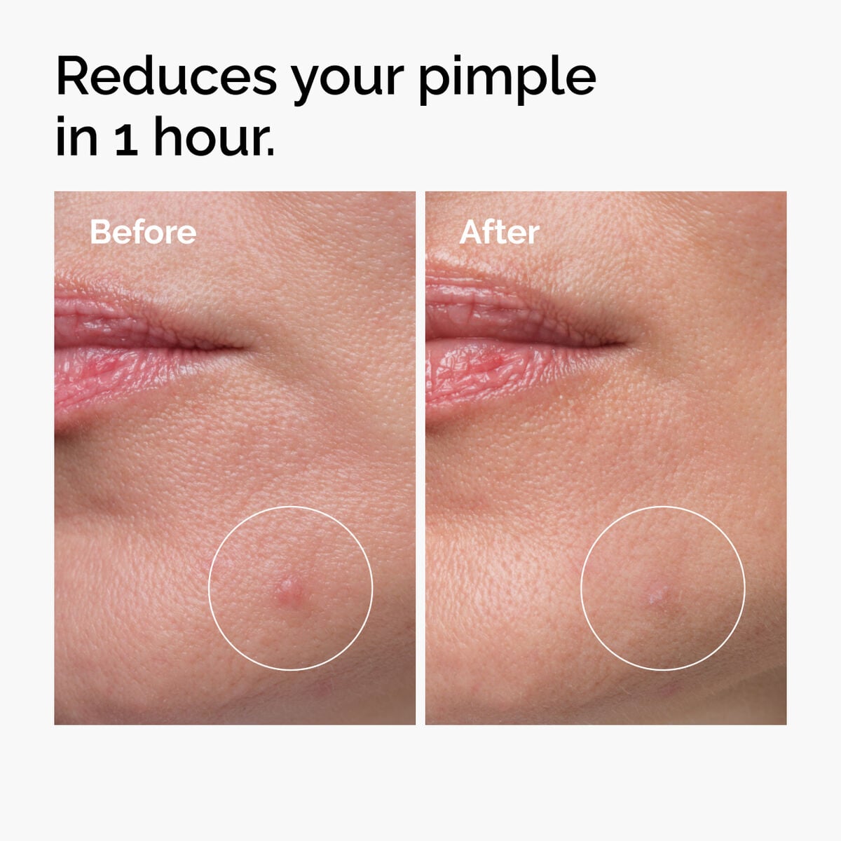 sulfur-10-powder-to-cream-concentrate-w2 ord-sulfur-10pct-powder-to-cream-concentrate-before-after-NA.jpg